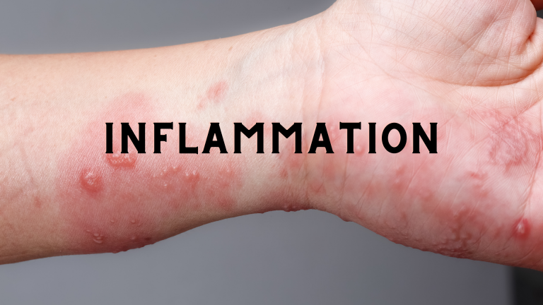 Everything You Need to Know About Inflammation and Your Skin – DNA ...